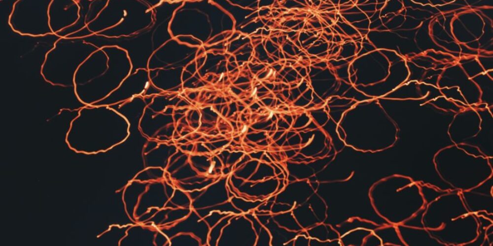 You should be spending more time thinking about longtail keywords and less about vanity terms_5ee33c2c21ba0.jpeg